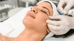 Nâng Chỉ Tái Sinh Làn Da - Có Thể Không?
