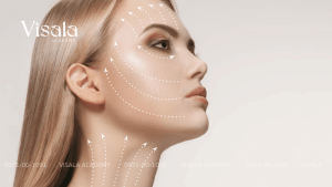 Nâng Chỉ Hạn Chế Mỡ Thừa - Điều Này Có Thể Không?